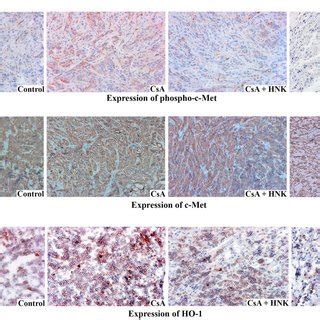 Hnk Down Regulates Both C Met And Cni Induced Secretion Of Angiogenic