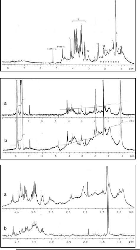 Figure From The Function Of The Blood Aqueous Barrier In Eyes With