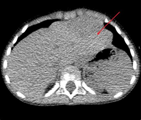 The Image Is Showing Multi Slice Computed Tomography MSCT Of The