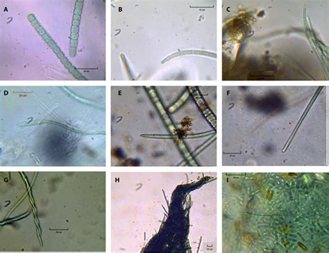 Cyanobacterial microflora under an optical microscope. (A) Komvophoron... | Download Scientific ...