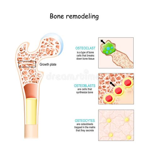 Bone Remodeling Process. Osteoblast, Osteoclast, and Osteocyte Stock ...