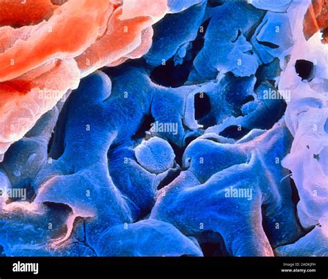 Alveolus False Color Scanning Electron Micrograph SEM Eines