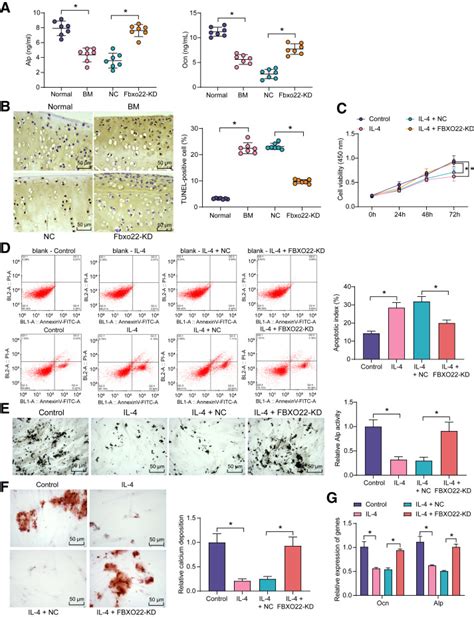 FBXO22 Mediates The NGF TRKA Signaling Pathway In Bone Metastases In