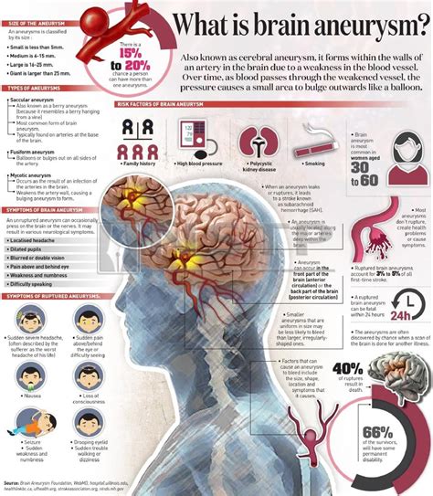 Infographic Brain Aneurysm