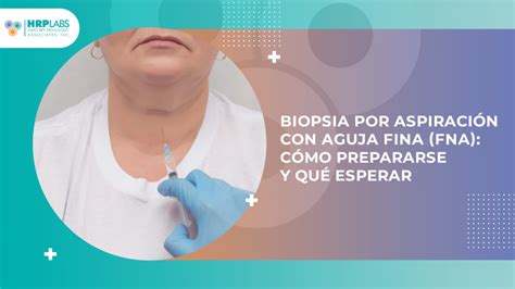 Biopsia Por Aspiraci N Con Aguja Fina Fna C Mo Prepararse Y Qu