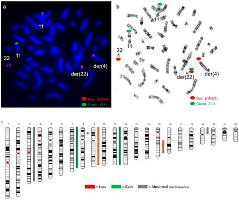 Genes Free Full Text Complexcryptic Ewsr1fli1erg Gene Fusions