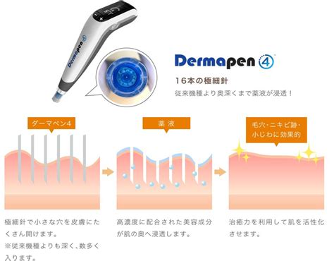 ダーマペン4｜トメモリ眼科・形成外科 和歌山県橋本市 岩出市 紀の川市 五條市
