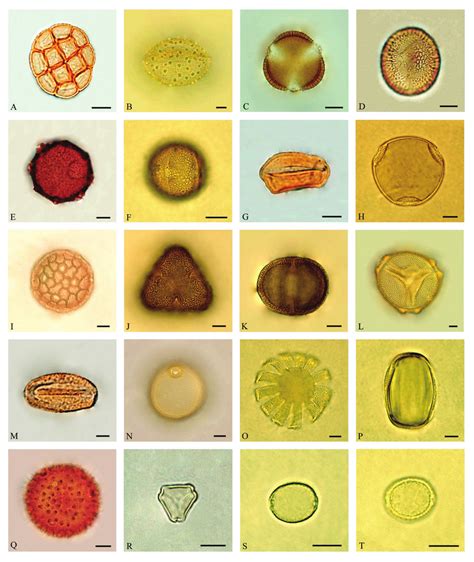 Some Pollen Types Obtained From Pollen Loads Of Apis Mellifera A Download Scientific Diagram