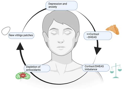 Vitiligo and Mental Health: Natural Compounds’ Usefulness