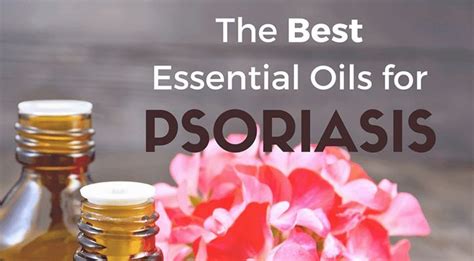 Best Essential Oils for Psoriasis - Recipe & Tea Tree Oil for Psoriasis ...