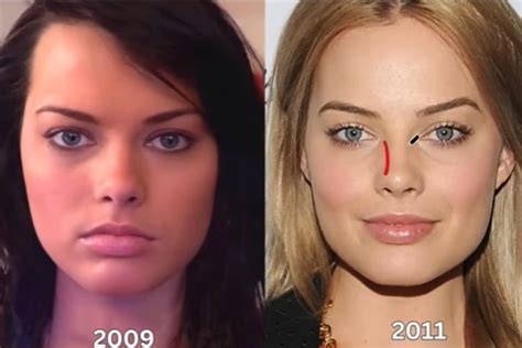 How Many Plastic Surgeries Did Margot Robbie Get Done To Look Like The Iconic Barbie Doll Marca