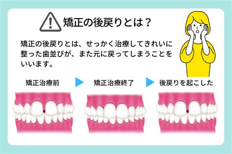 部分矯正は後戻りしやすいの？どんな理由で起こるの？｜医療法人真摯会 大阪矯正歯科グループ