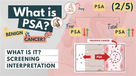 Prostate Specific Antigen PSA Overview For Med Students Urology