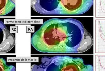 Critères de substitution pour lévaluation de la survie lors des essais