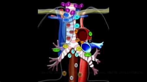 Video Assisted Mediastinoscopic Lymphadenectomy Vamla A Video