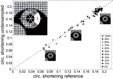 Comparison Of Peak Circumferential Shortening From Undersampled R 3