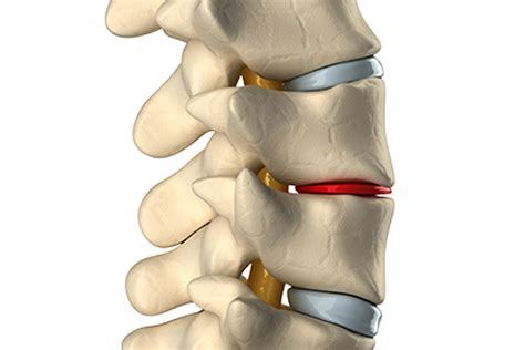 Conditions We Treat Spinal Rehab Clinics