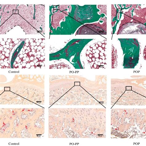 Histological Analysis Of Bone Repair After Scaffold Implantation A