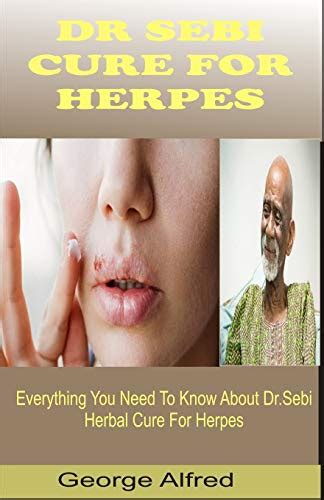 Dr Sebi Cure For Herpes Everything You Need To Know About Bi