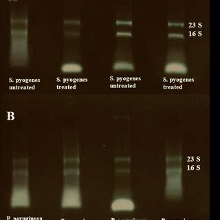 Agarose gel electrophoresis of RNA samples. (A) Quality control for the ...