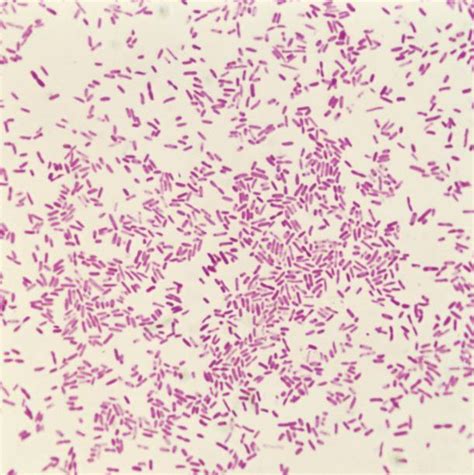 Shigella Dysenteriae Pictures Getty Images