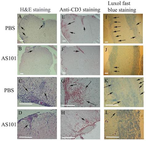 Less Severe Inflammatory Cell Infiltration And Demyelination In Spinal