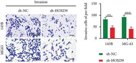 Downregulation Of Hoxd9 Inhibits Os Cell Proliferation Migration