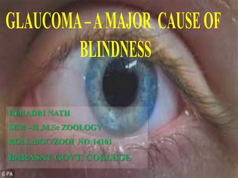 Glaucoma A Major Cause Of Blindness Ppt