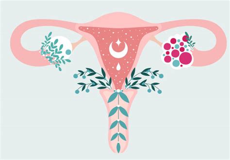 360 Polycystic Ovary Syndrome Stock Illustrations Royalty Free Vector