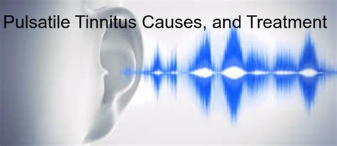 Pulsatile Tinnitus Causes And Treatment