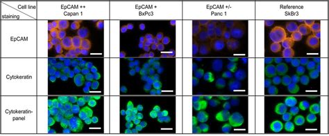 Cytokeratin Expression In Pancreatic Cancer Pancreatic Cancer Cell