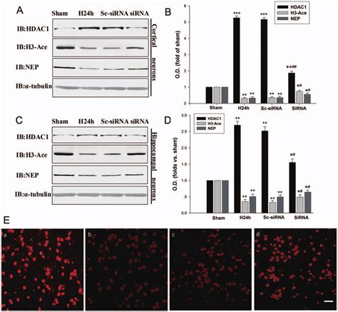 Hypoxia Decreases H Ace Through Hdac Accumulation A B C D