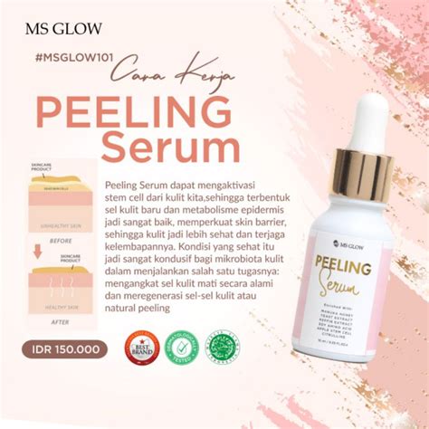 Jual Peeling Serum Ms Glow Shopee Indonesia