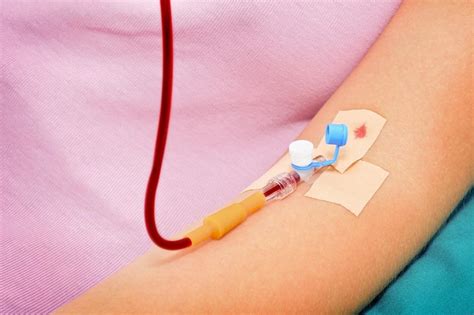 Blood Transfusions During Pregnancy - American Pregnancy Association