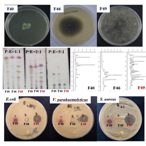 | Scanning electron microscopy (SEM) images of S. aureus cells (× ... 