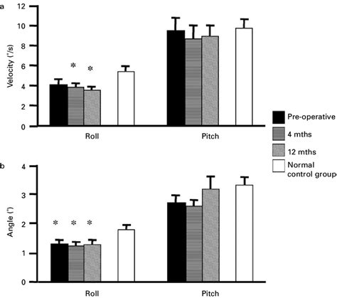 Bar Charts Showing The Mean Values For Trunk Sway A Velocity And B