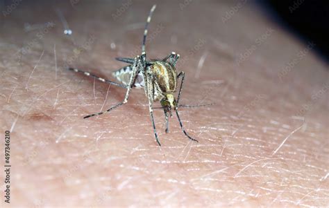 Dangerous Malaria Infected Mosquito Skin Bite Leishmaniasis