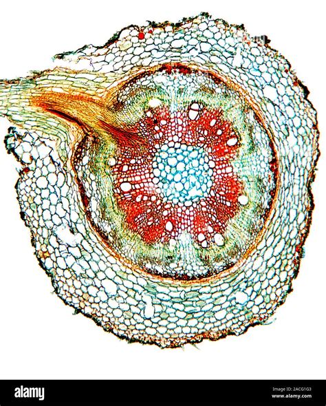 La Alubia root Luz micrografía de una sección a través de la raíz de