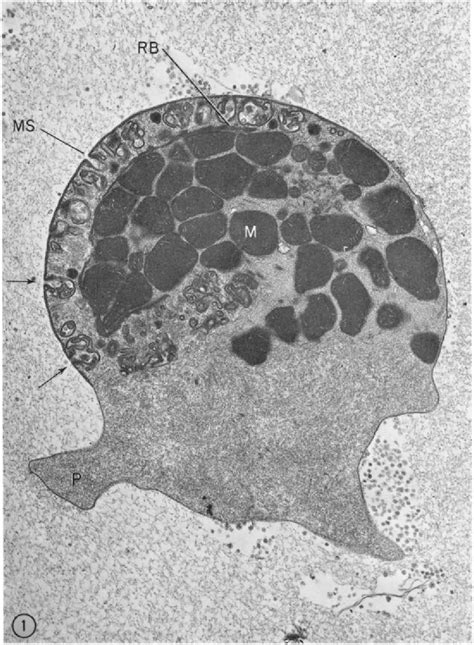 Ascaris Lumbricoides Semantic Scholar