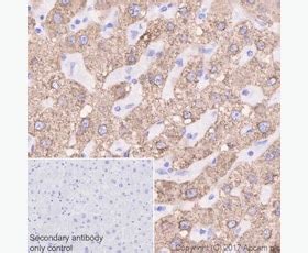 Results for "MGST1" | Abcam: antibodies, proteins, kits...