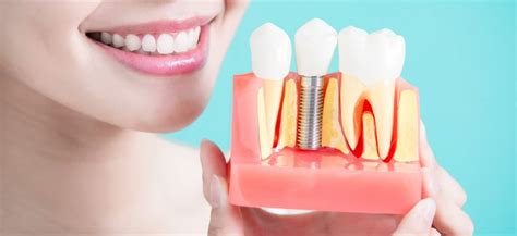 Dental Implant Maintenance Tips For Keeping Your New Teeth Looking And