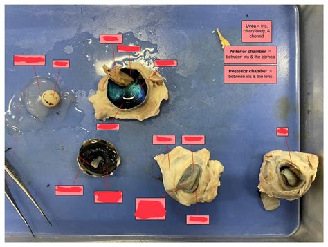 eye dissection Diagram | Quizlet