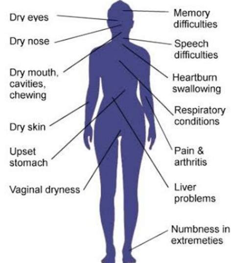 Mengenal Sjogren S Syndrome Dokter Rematik Autoimun