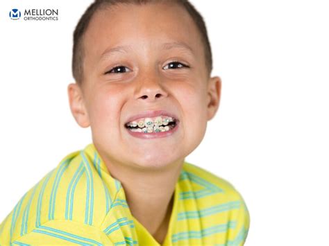 Orthodontic Treatment And Braces For Kids Mellion Orthodontics