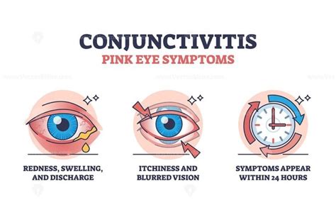 Conjunctivitis Or Pink Eye Symptoms With Simple Explanation Outline