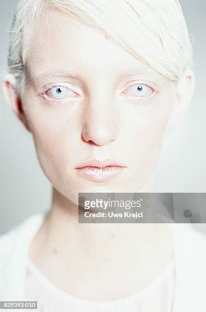 Albino People With Blue Eyes