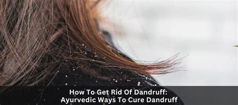 How To Get Rid Of Dandruff 10 Ayurvedic Ways To Cure Dandruff