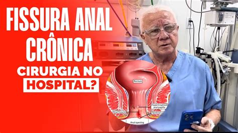 Cirurgia Fissura Anal Crônica Faço Somente No Hospital Youtube