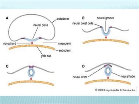 Neural tube defects