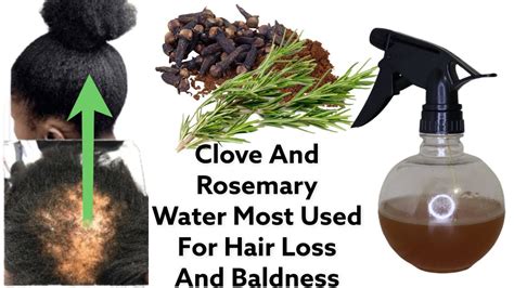 Clove Water And Rosemary Stop Hair Loss Spray Times A Day